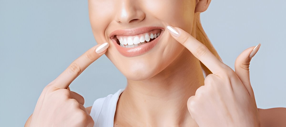 Smile Makeover Edmonton